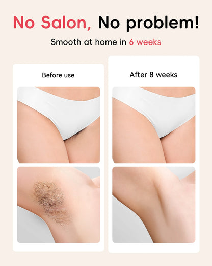 IPL Hair Removal Laser 22J — Unlimited Flashes IGBT, 5.2cm² Light Painless Epilator for Face, Armpit & Bikini Body Treatment