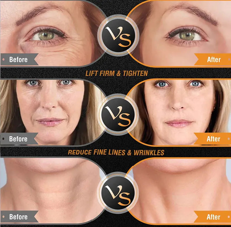 EMS Facial & Body RF Machine – Professional Radio Frequency Beauty Device for Skin Tightening, Face Lifting, and Anti-Aging