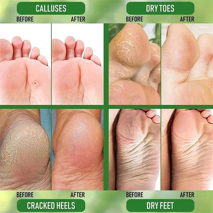 Herbal Heel Repair Foot Cream – Cracked Heel Care, Dead Skin Exfoliation & Deep Moisturizing for Soft, Smooth Feet