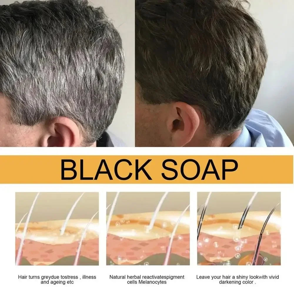 Polygonum Multiflorum Black Hair Soap — Darkening Shampoo Bar for Gray Hair Repair, Face & Body, Men & Women