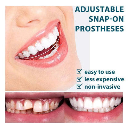 Teeth Veneers & Whitening Denture Kit – Temporary False Teeth Cover for Comfortable, Perfect Smile