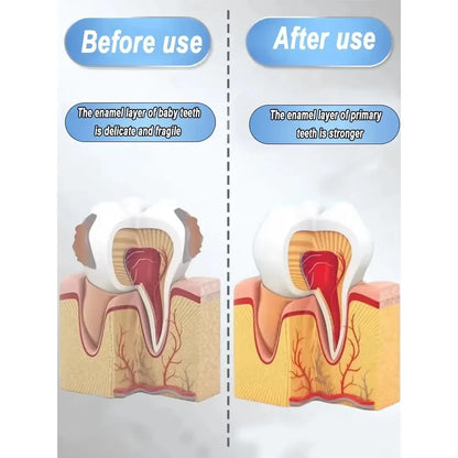 Cavity Removal & Gum Repair Oral Care – Clears Oral Bacteria for Healthy Gums