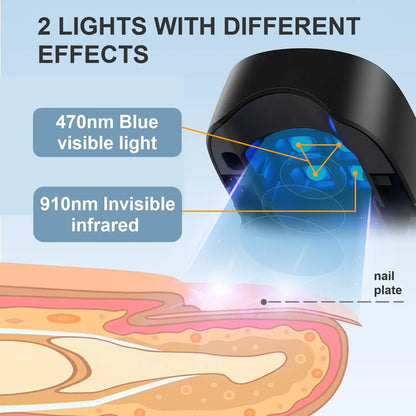 Nail Fungus Cleaning Light Device – USB Charge, 905nm Infrared & 470nm Blue Light for Onychomycosis Treatment