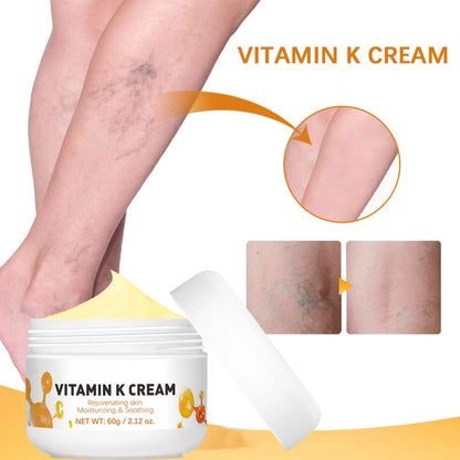 Vitamin K Leg Care Cream - Soothing Massage Cream for Tired Legs, Varicose Vein & Spider Vein Appearance Support