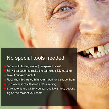Temporary Tooth Repair Beads – DIY Dental Filling Material for Broken or Missing Teeth