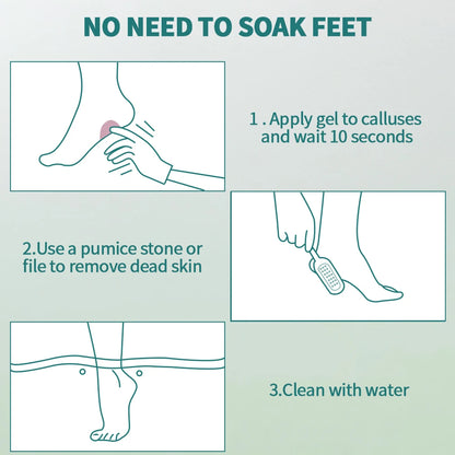 NAILPOP Extra Strength Callus Remover & Foot File Kit - Fast Hard Skin, Heel & Tough Callus Removal