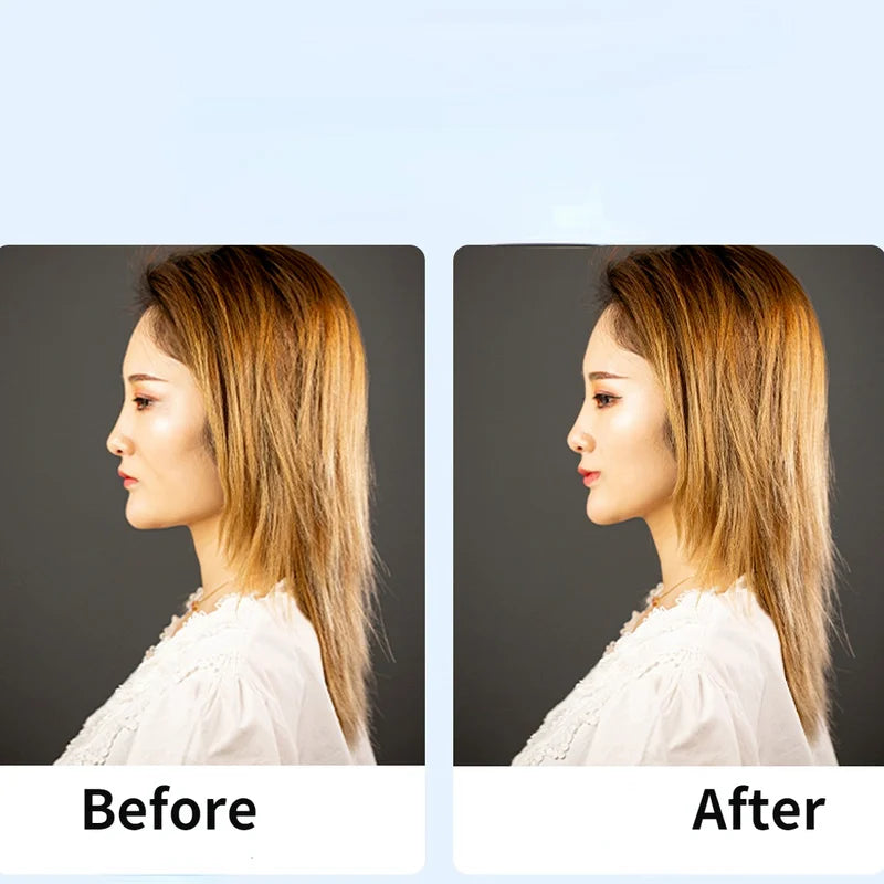 Elastic Lift Straps for Eyes and Eyebrows - Adjustable BB Clip Bands for Anti-Wrinkle Face Taping and Hair Lifting
