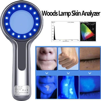 Woods Lamp Skin Analyzer - UV Magnifying Facial Skin Testing Light for Beauty Care Analysis Detection