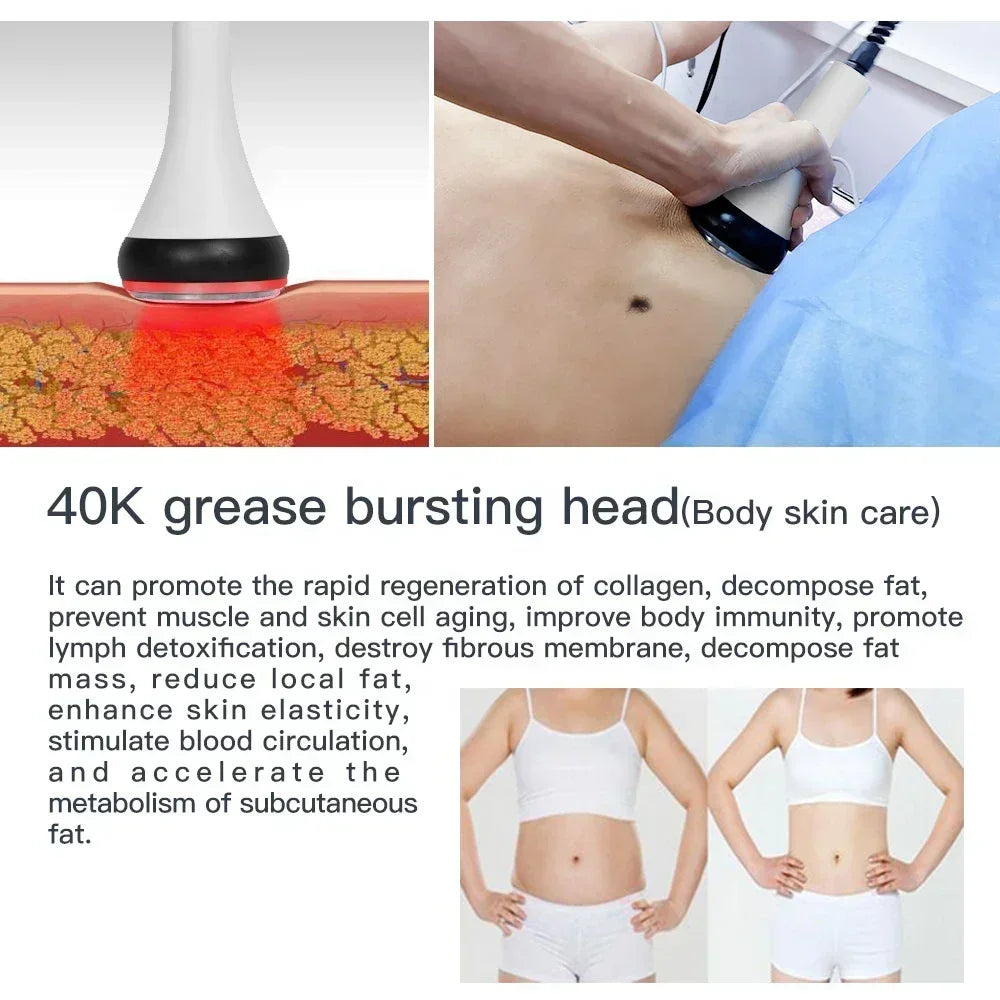 40K Ultrasonic Cavitation Machine – Body Slimming & Facial Lifting RF Beauty Massager for Weight Loss