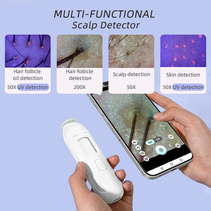 50X–200X Hair Follicle & Scalp Analyzer Microscope – High Definition Skin Detector with App Support Wireless Skin Testing Tool