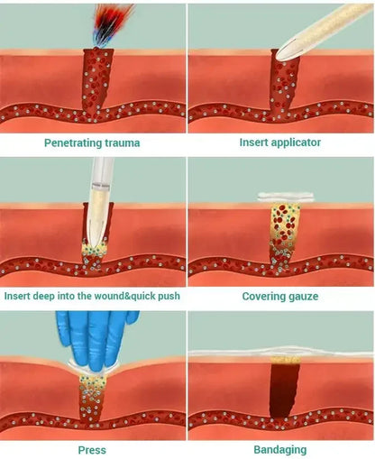 6g Chitosan Powder Applicator — Fast Hemostatic Granule Bandage for Tactical Emergency, Medical Care & Survival Kit
