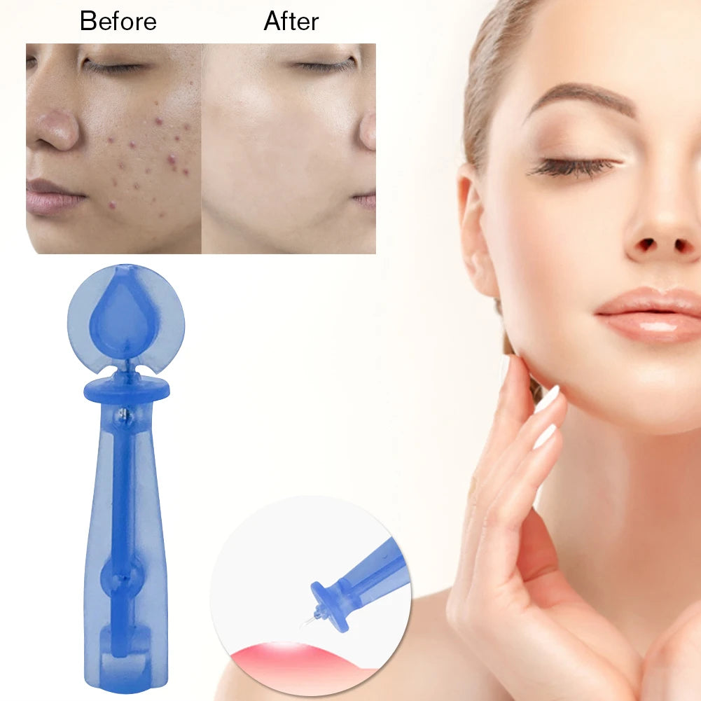 50/100PCS Blackhead Remover Acne Needle Tool - Disposable Skin Care Tools for Acne & Fat Grain Removal