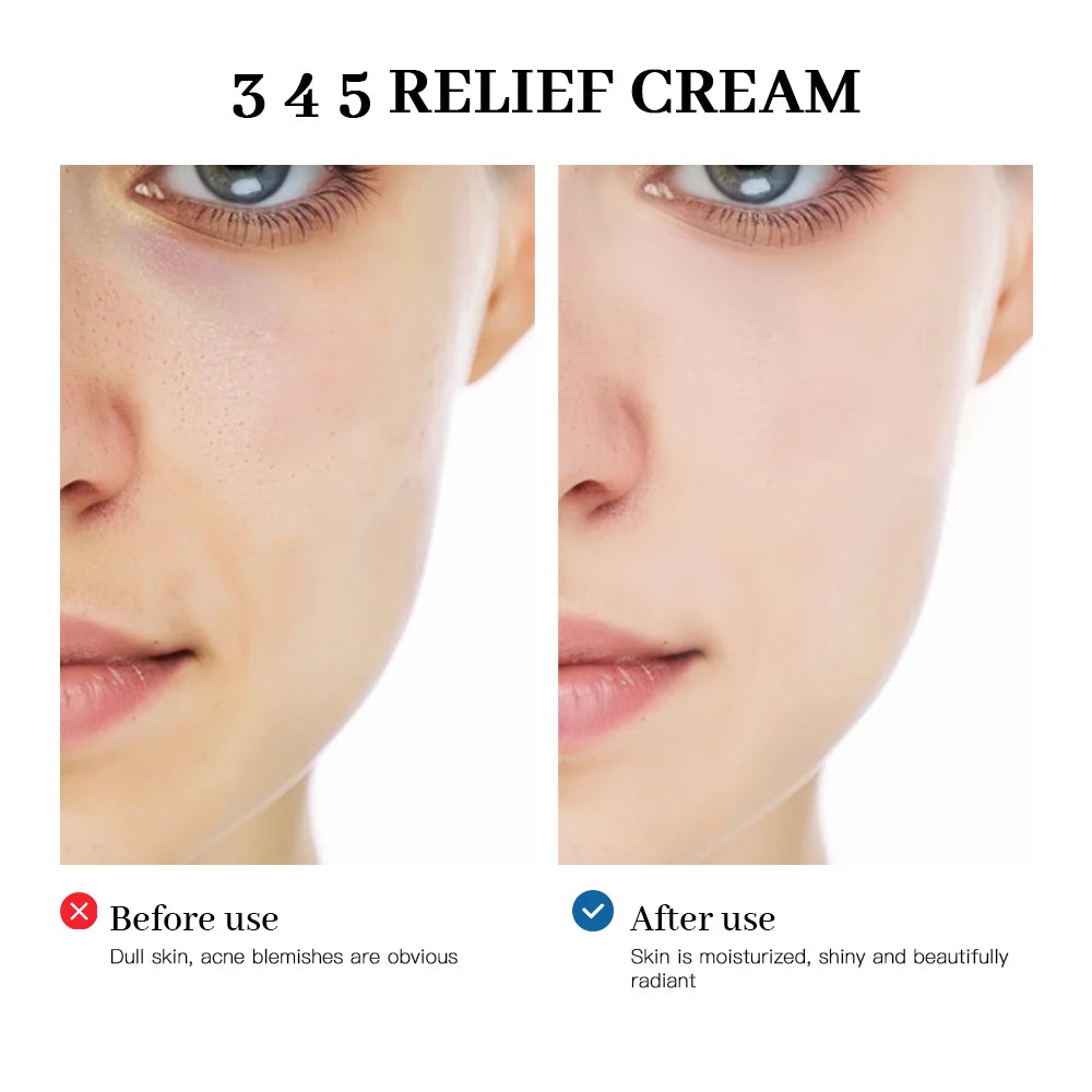 345 Relief Cream — Anti-Aging, Brightening & Acne Scar Repair Skincare