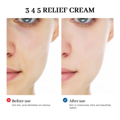 345 Relief Cream — Anti-Aging, Brightening & Acne Scar Repair Skincare
