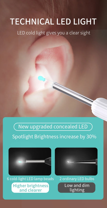 Smart Visual Ear Cleaner 1296P with Camera – USB-C Rechargeable Ear Wax Removal Tool, WiFi, 6 LED Lights