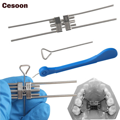 Dental Expansion Screw Ortho Expander – Rapid Palatal Tool with Swivel Keys for Orthodontic Frame (8/9/11/13mm)