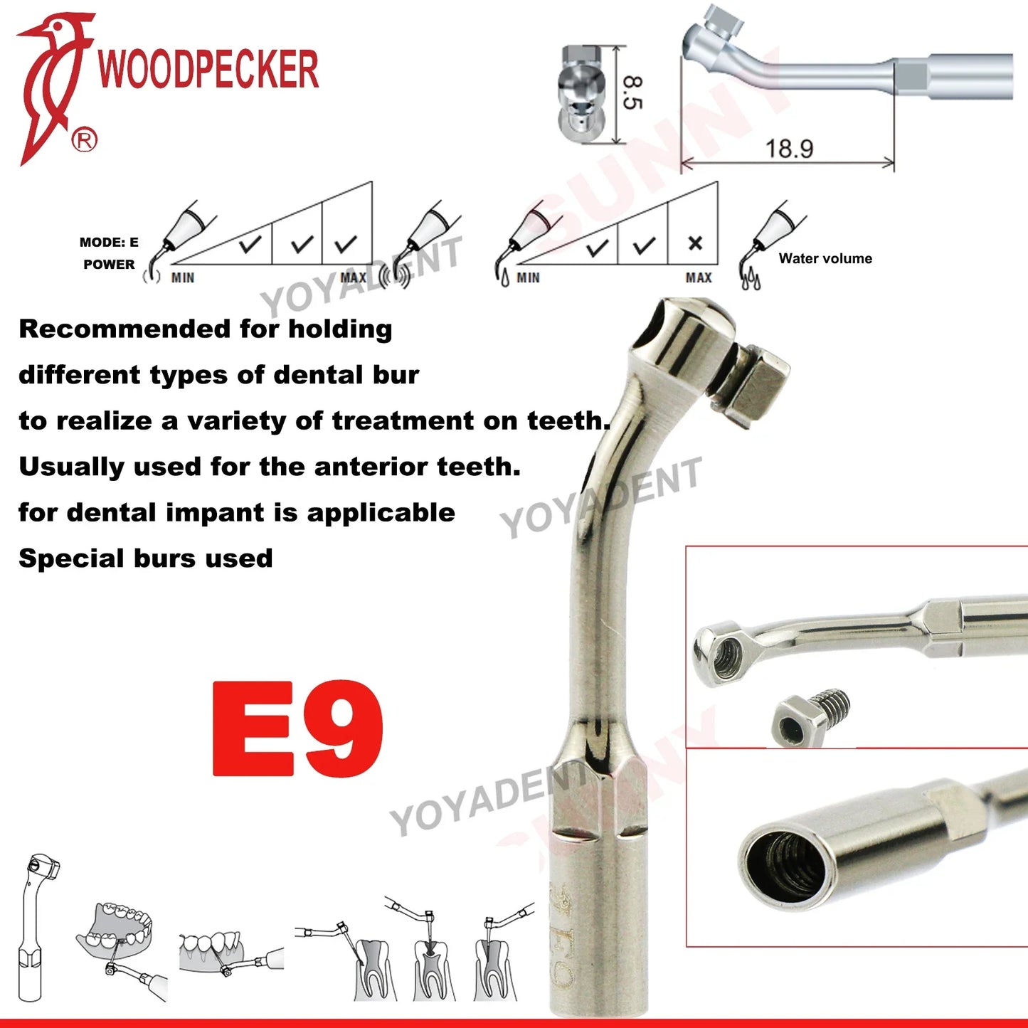 Woodpecker Dental Scaler Tips – Ultrasonic Tooth Cleaning, Endo & Perio Scaling Tips, Fit EMS UDS Scaler Handpiece