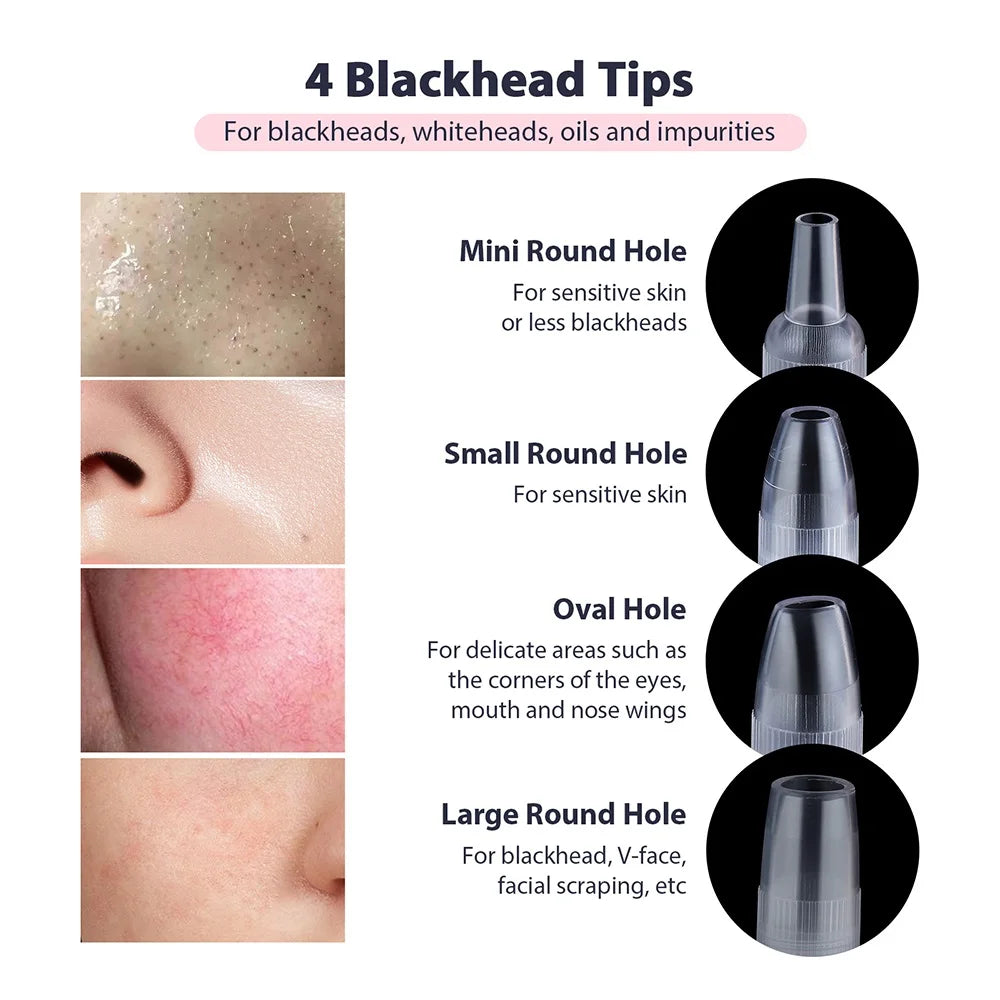 Foreverlily Portable Diamond Peeling Machine – Microdermabrasion Facial Cleaner & Blackhead Remover Vacuum Device