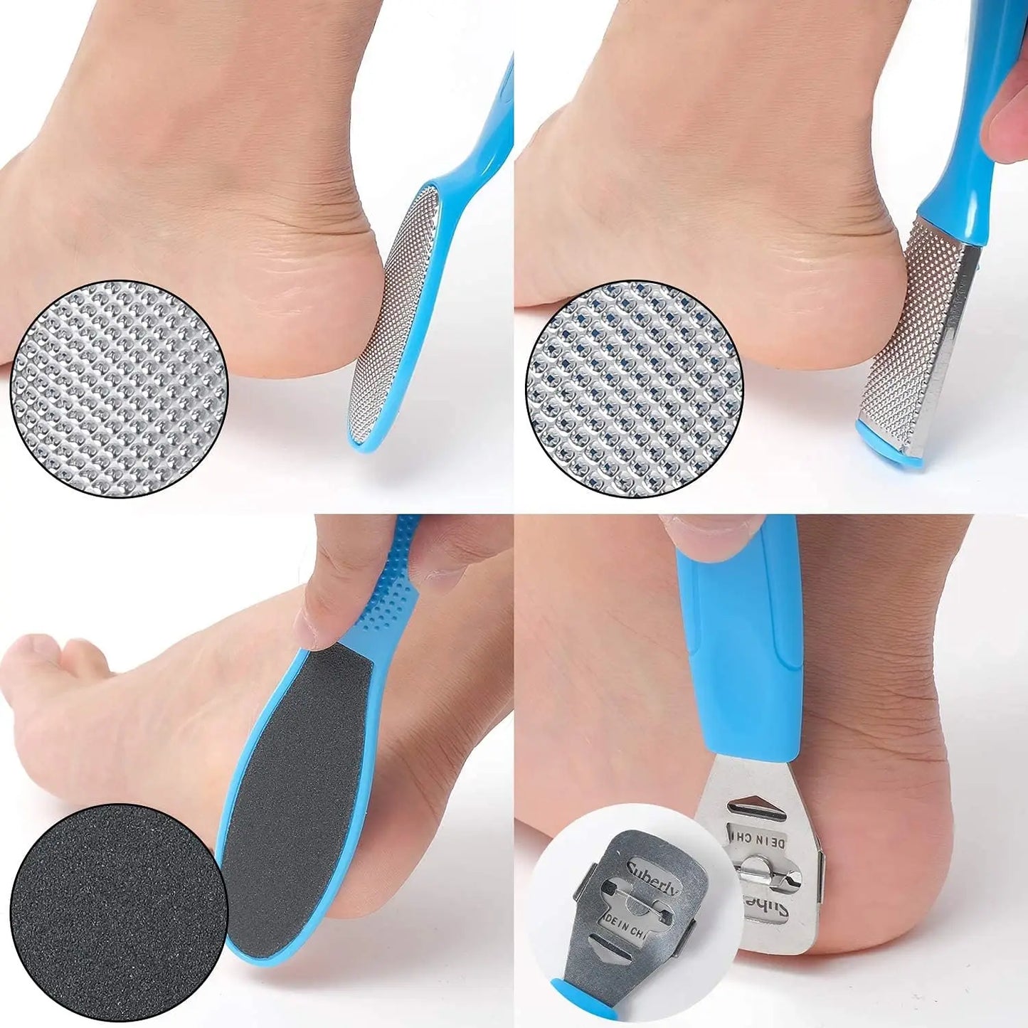 8 Piece Foot Exfoliating File Set - Octopus Fish Eye Heel Scraper for Callus Removal, Cracked Heel and Sole Care