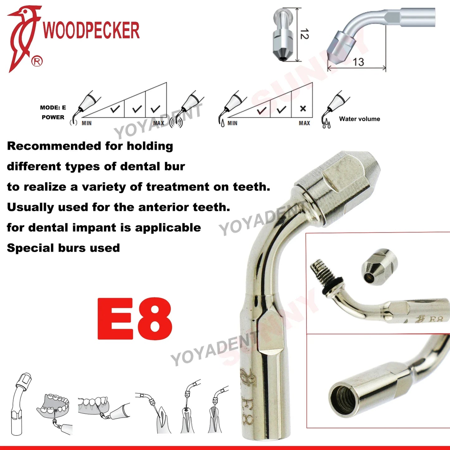 Woodpecker Dental Scaler Tips – Ultrasonic Tooth Cleaning, Endo & Perio Scaling Tips, Fit EMS UDS Scaler Handpiece