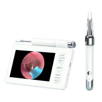 DDCAMERA 4.3" Digital Otoscope – 1080P Ear Scope with 6 LED Lights for Ear Wax Removal, Photo & Video Support