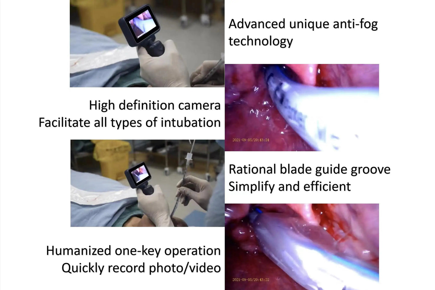 3.5-Inch Touch Screen Video Laryngoscope with Reusable Sterilizable Blades – Digital Laryngoscope, Mexico Warehouse Delivery