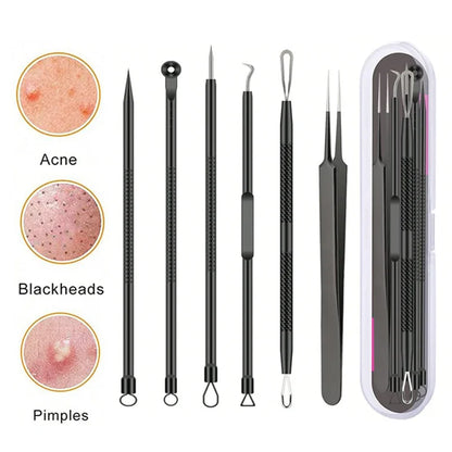 4/6PCS Face Cleaning Kit – Pimple, Blackhead & Whitehead Remover Tools for Acne and Comedone Care
