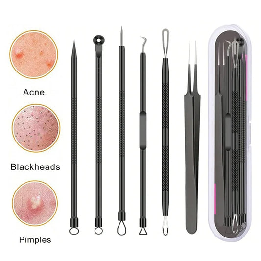 4/6PCS Face Cleaning Kit – Pimple, Blackhead & Whitehead Remover Tools for Acne and Comedone Care