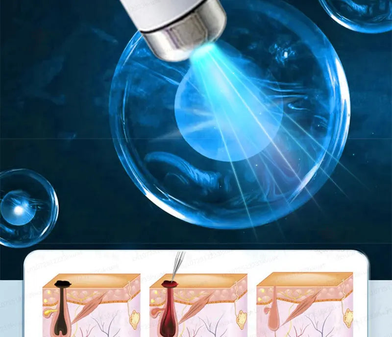 Safe Skin-Friendly Wart Removal Methods – Gentle Solutions for Effective Wart Treatment