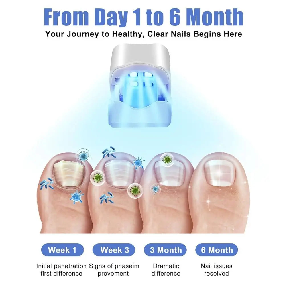 Rechargeable Nail Care LED Light Device - UV-Free Toenail Treatment Lamp for Home Foot Care