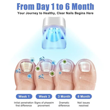 Rechargeable Nail Care LED Light Device - UV-Free Toenail Treatment Lamp for Home Foot Care