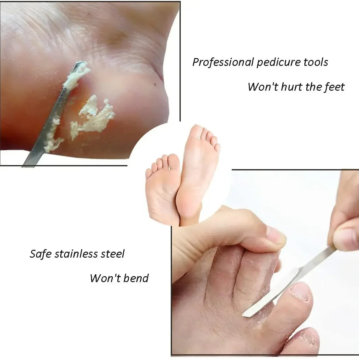 Stainless Steel Foot Callus Remover - Pedicure Exfoliating Scraper for Dead Skin and Callus Foot Care