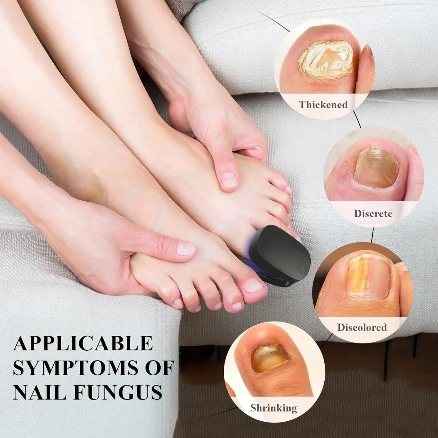 Nail Fungus Cleaning Light Device – USB Charge, 905nm Infrared & 470nm Blue Light for Onychomycosis Treatment