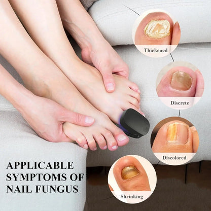 Nail Fungus Cleaning Light Device – USB Charge, 905nm Infrared & 470nm Blue Light for Onychomycosis Treatment