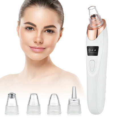 3-Mode Blackhead Remover Vacuum – Facial Pore Cleaner & Dead Skin Removal Beauty Tool