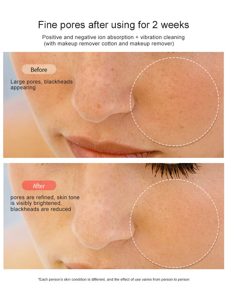 New RF Facial Lifting & Firming Beauty Device - EMS Microcurrent Rejuvenation, Home Face Care Tool, Perfect Gift Idea        4o