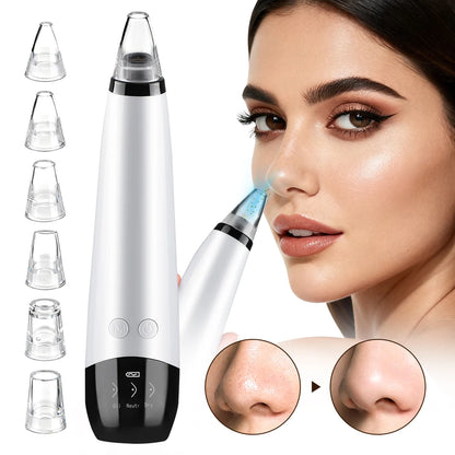 3-Mode Blackhead Remover Vacuum – Facial Pore Cleaner & Dead Skin Removal Beauty Tool