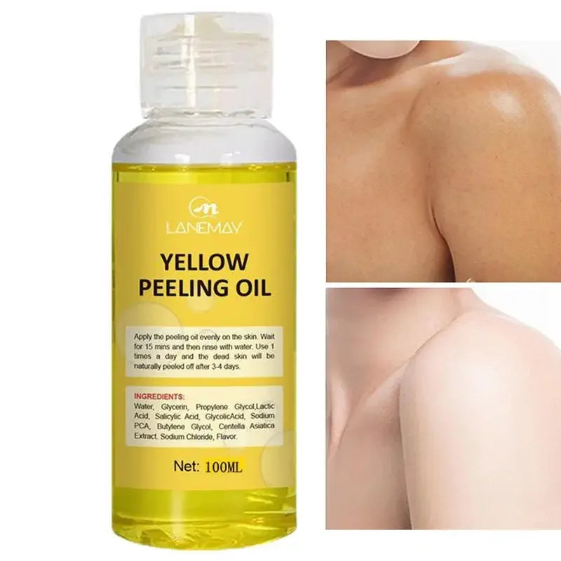 Yellow Peeling Oil – Skin Lightening & Melanin Treatment for Elbows, Knees, Hands, and Even Skin Tone