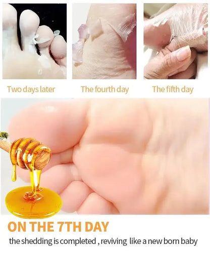 Honey Foot Mask – 1 Pair for Dead Skin & Callus Removal, Exfoliating Foot Treatment, Whitening Foot Spa & Skin Care Tool