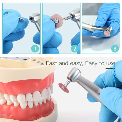 Dental Finishing & Polishing Discs – Superfine, Fine, Medium, Coarse for Composites, Ceramics & Glass Ionomer