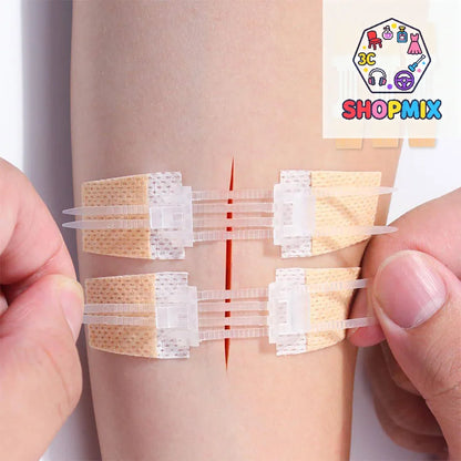 1–20-Piece Zipper Wound Closure Patch Set - Suture-Free Wound Dressing Strips for First Aid and Outdoor Care