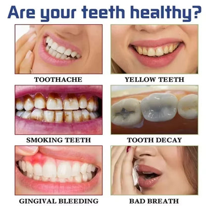 SP-10 Fresh Breath & Whitening Toothpaste – Removes Plaque, Yellow Stains & Supports Gum Health for Oral Care