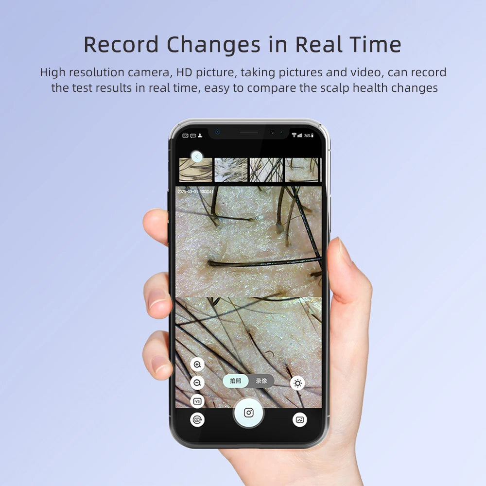 50X–200X Hair Follicle & Scalp Analyzer Microscope – High Definition Skin Detector with App Support Wireless Skin Testing Tool