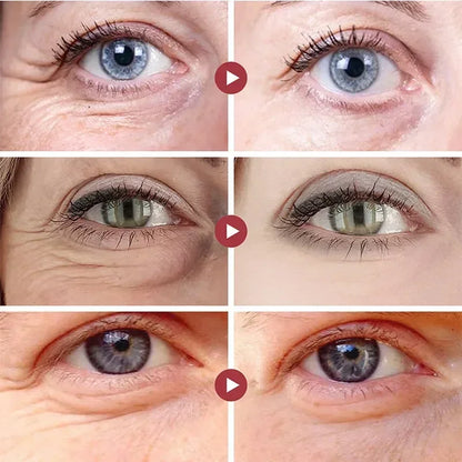 Collagen Eye Mask – Wrinkle Removal, Firming & Moisturizing Patches with Hyaluronic Acid for Smooth Eye Skin