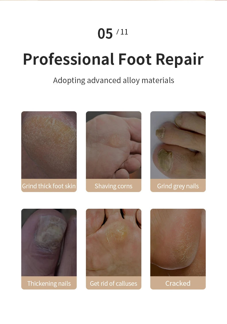 HOMFISH Electric Foot Grinder – Automatic Callus Remover Pedicure Machine for Smooth and Beautiful Feet