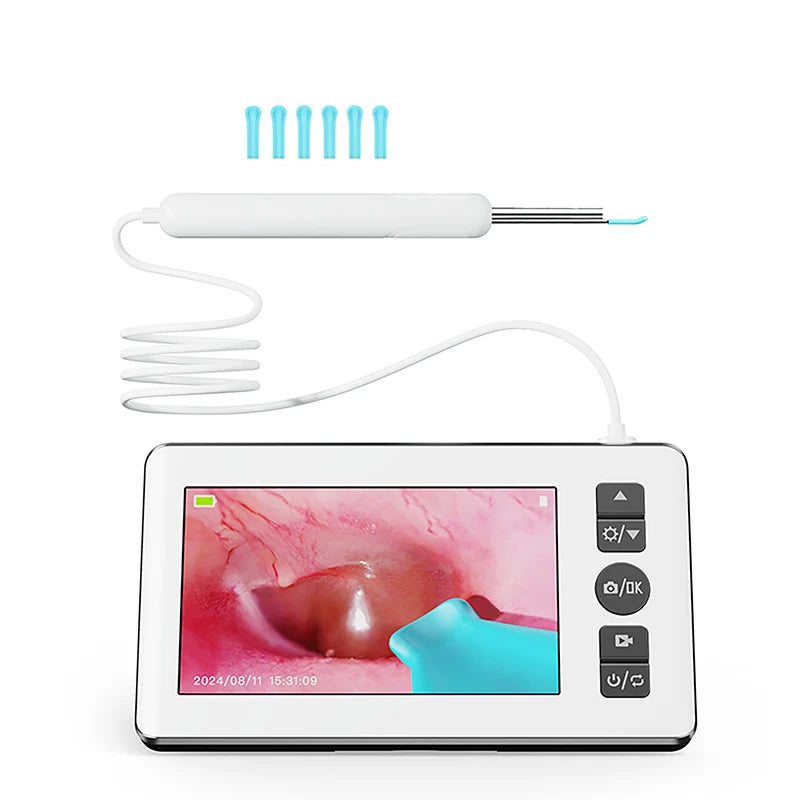 GUANMOU Digital Otoscope – 3.9mm Ear Scope Camera with 6 LED Lights, 4.3" IPS Ear Wax Removal Tool for Kids & Adults