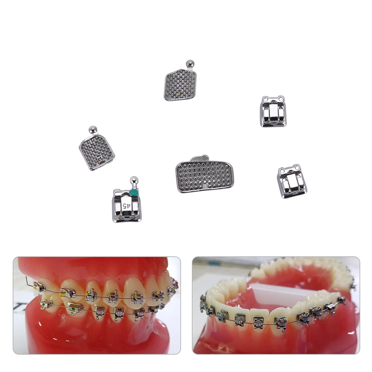 AZDENT 5 Boxes Dental Brackets – Passive Self-Ligating Orthodontic Braces with MIM Monoblock & Buccal Tubes, MBT/Roth 0.022, 345 Hooks
