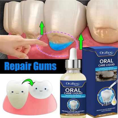 60ML Gum Repair Gel Serum - Sore Gum Relief Dental Care for Teeth Cleaning, Stains, Tartar & Oral Health
