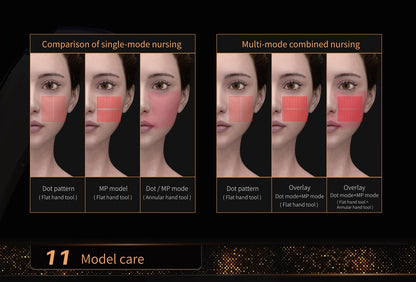 High-Quality MPTSTL TT 2-in-1 Skin Tightening & Wrinkle Removal Machine – 360° Anti-Wrinkle Facial Lift, New Model