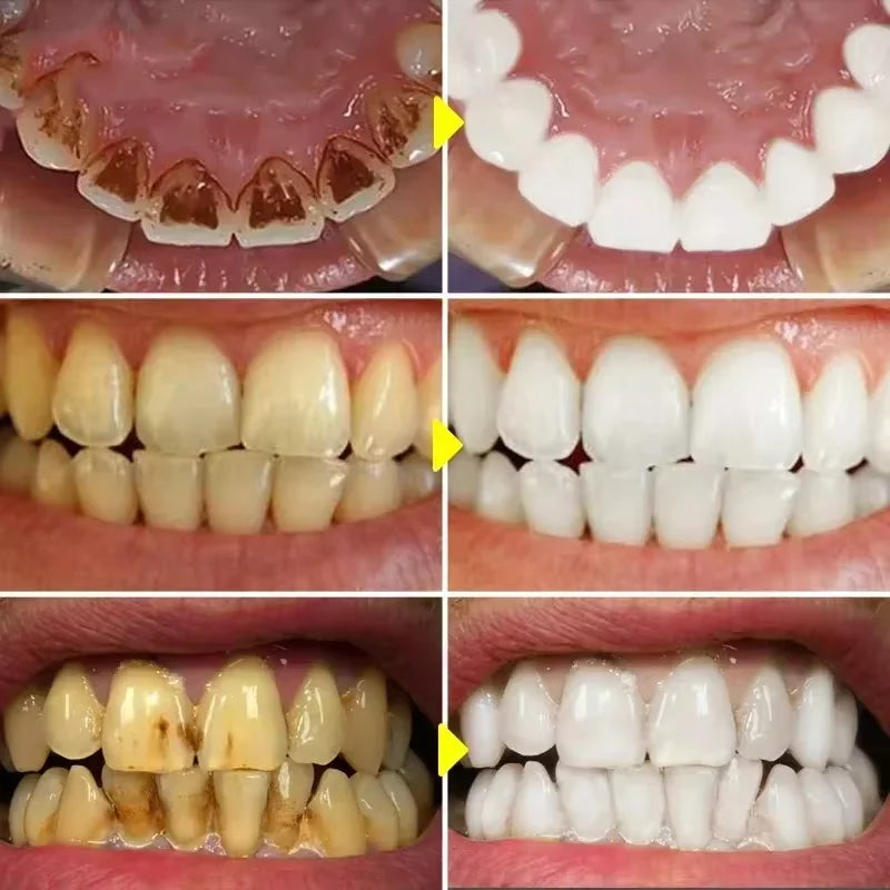 SP-10 Fresh Breath & Whitening Toothpaste – Removes Plaque, Yellow Stains & Supports Gum Health for Oral Care